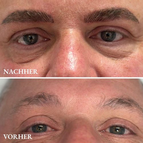 Microblading Ergebnis bei männlichen Augenbrauen – definierter, natürlicher Look im Goldenstudio Fellbach.