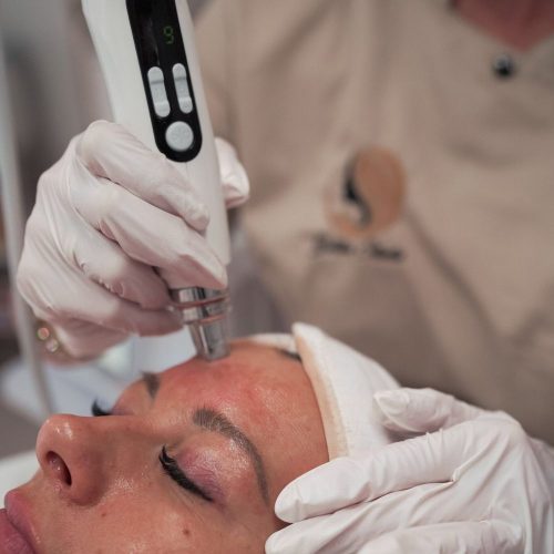 Behandlung einer Kundin mit der NanoGlow Gesichtsreinigung von Kosmetikerin Elisabeta, für strahlend schöne Haut in Fellbach.